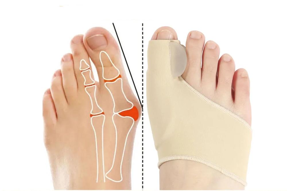 Toe Corrector Sock With Gel Cushions – Bunion & Big Toe Pain Relief (1 Pair)