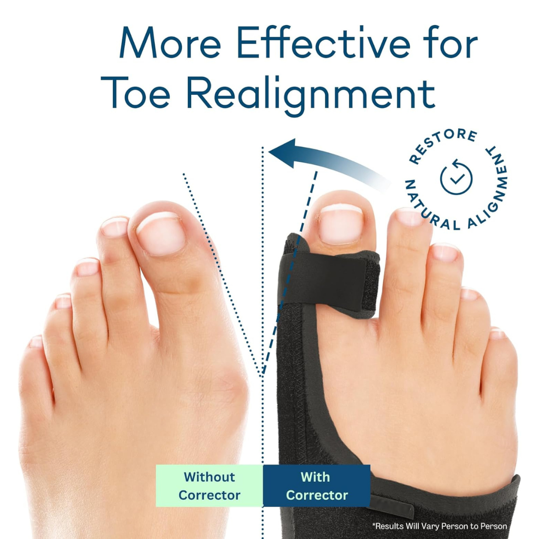 Hyggear Adjustable Day And Night Use Toe Fixed Strap (with Built-in Aluminum Strip)